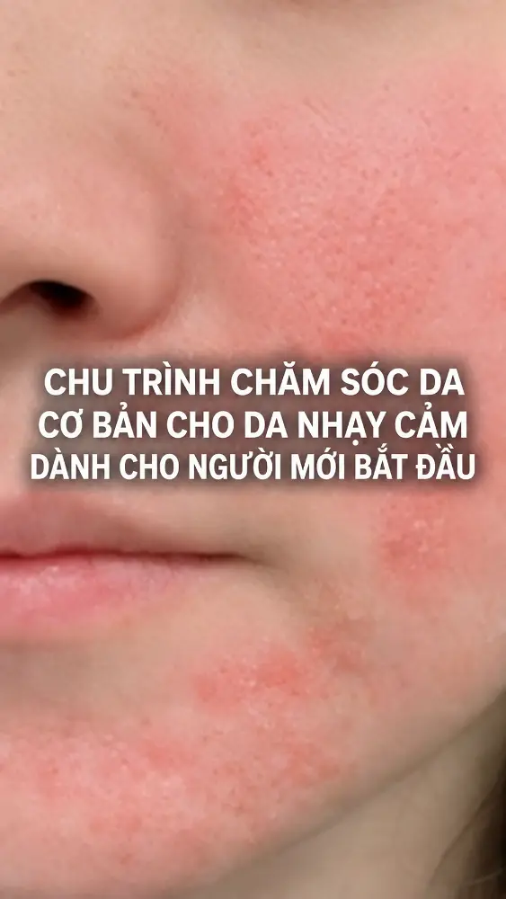Chu trình chăm sóc da cơ bản cho da nhạy cảm dành cho người mới bắt đầu